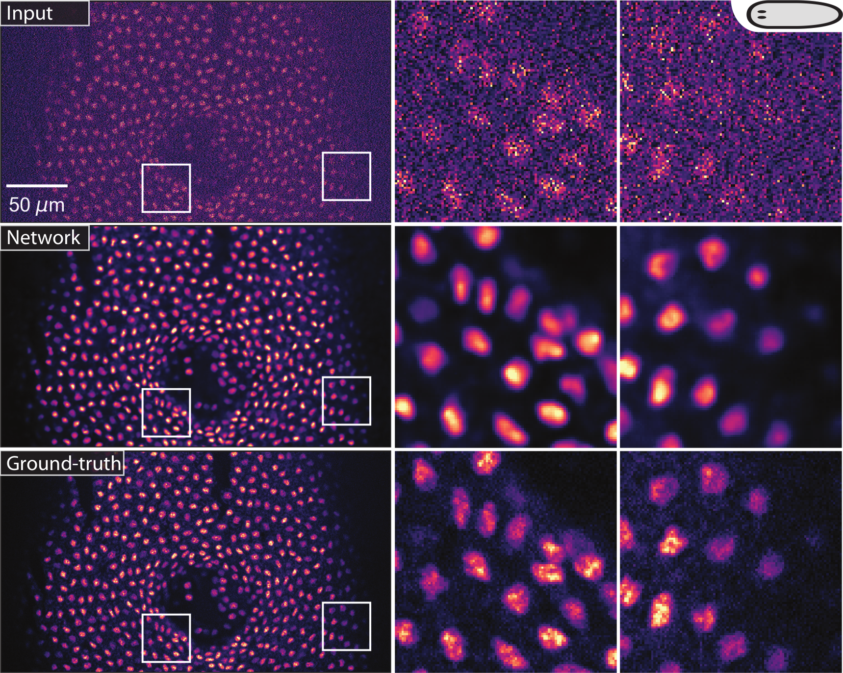 CARE network restoring a low-SNR flatworm image