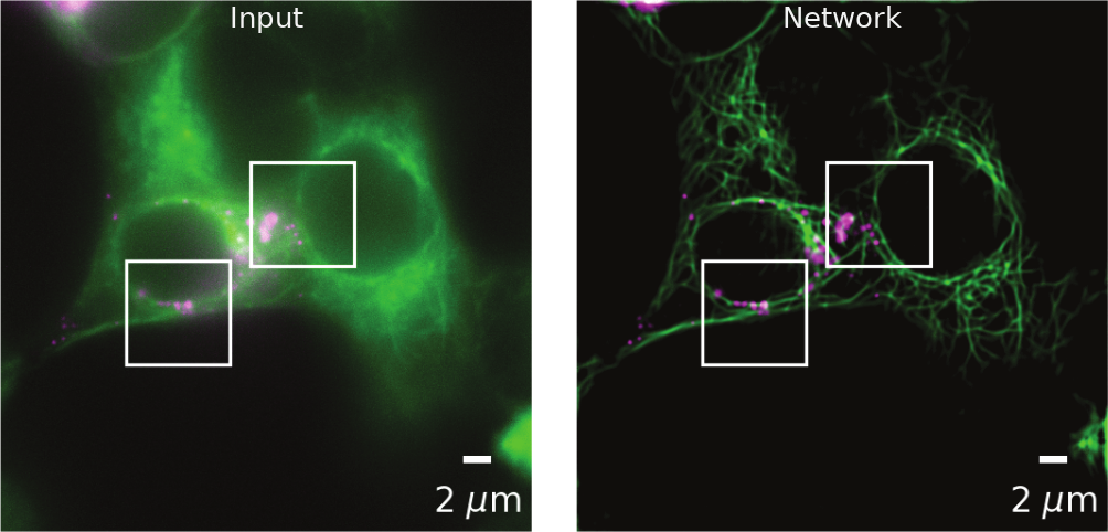 Diffraction-limited structure enhancement: rat INS-1 cell 1